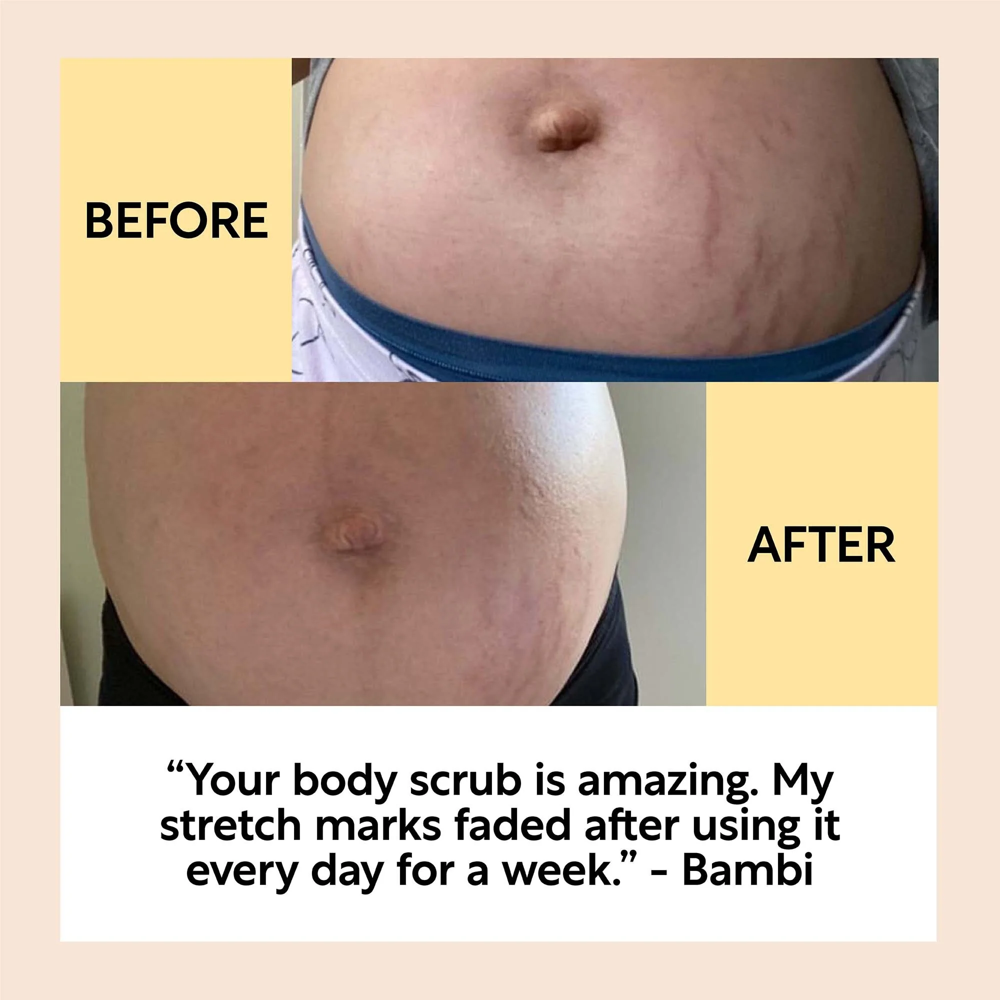 Bodycare Bundle - Image 7