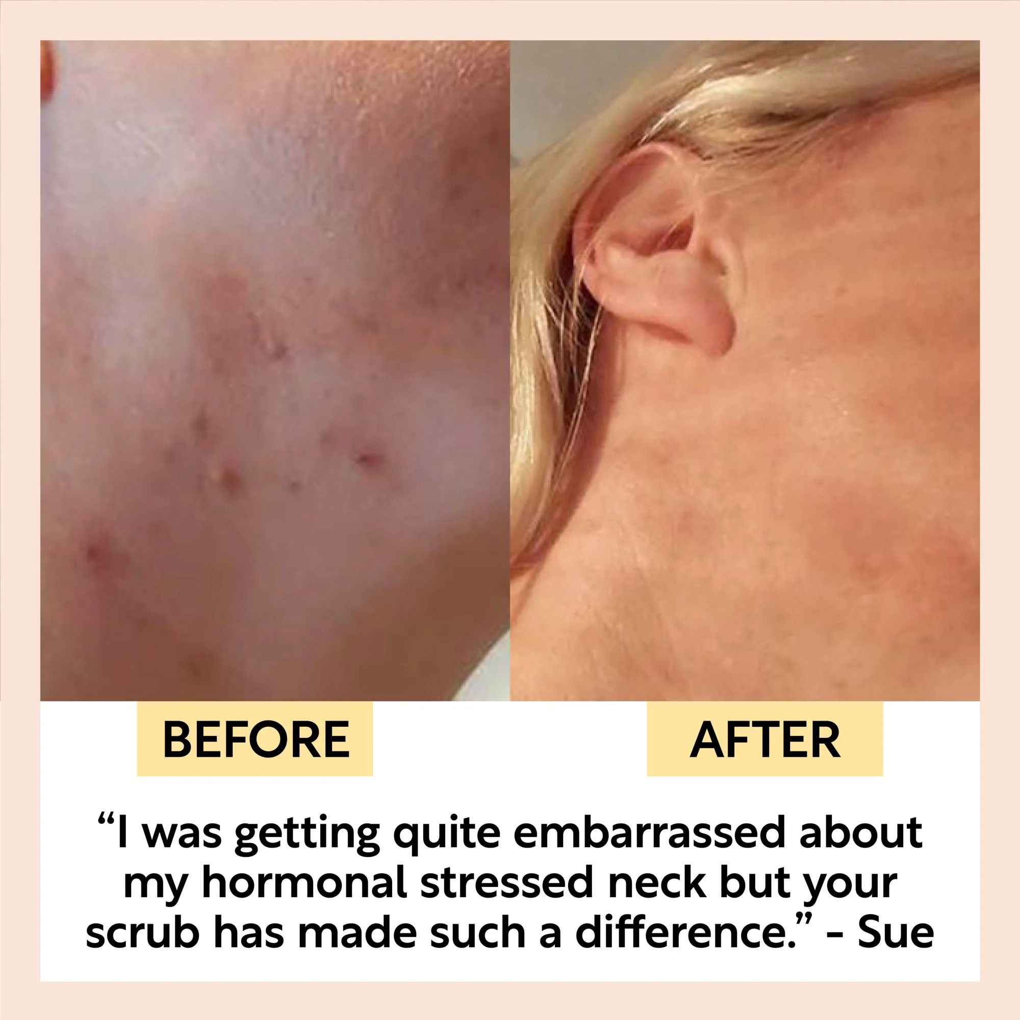 Face Scrub with Coffee + Rosehip Oil - Image 11