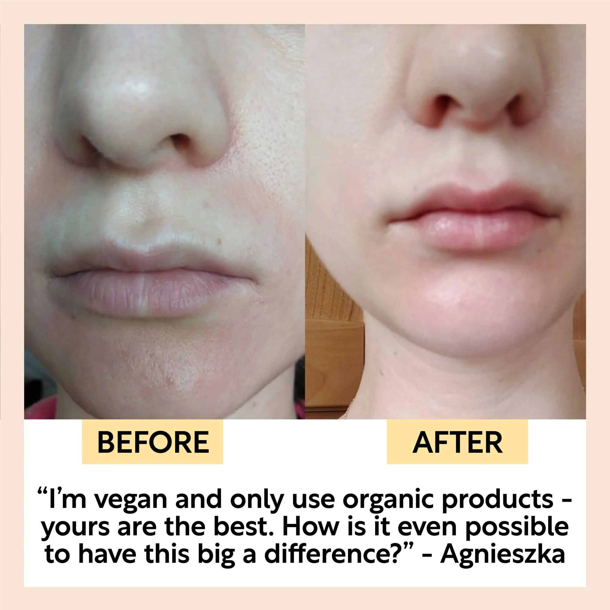 The Dry Skin Bundle - Image 6