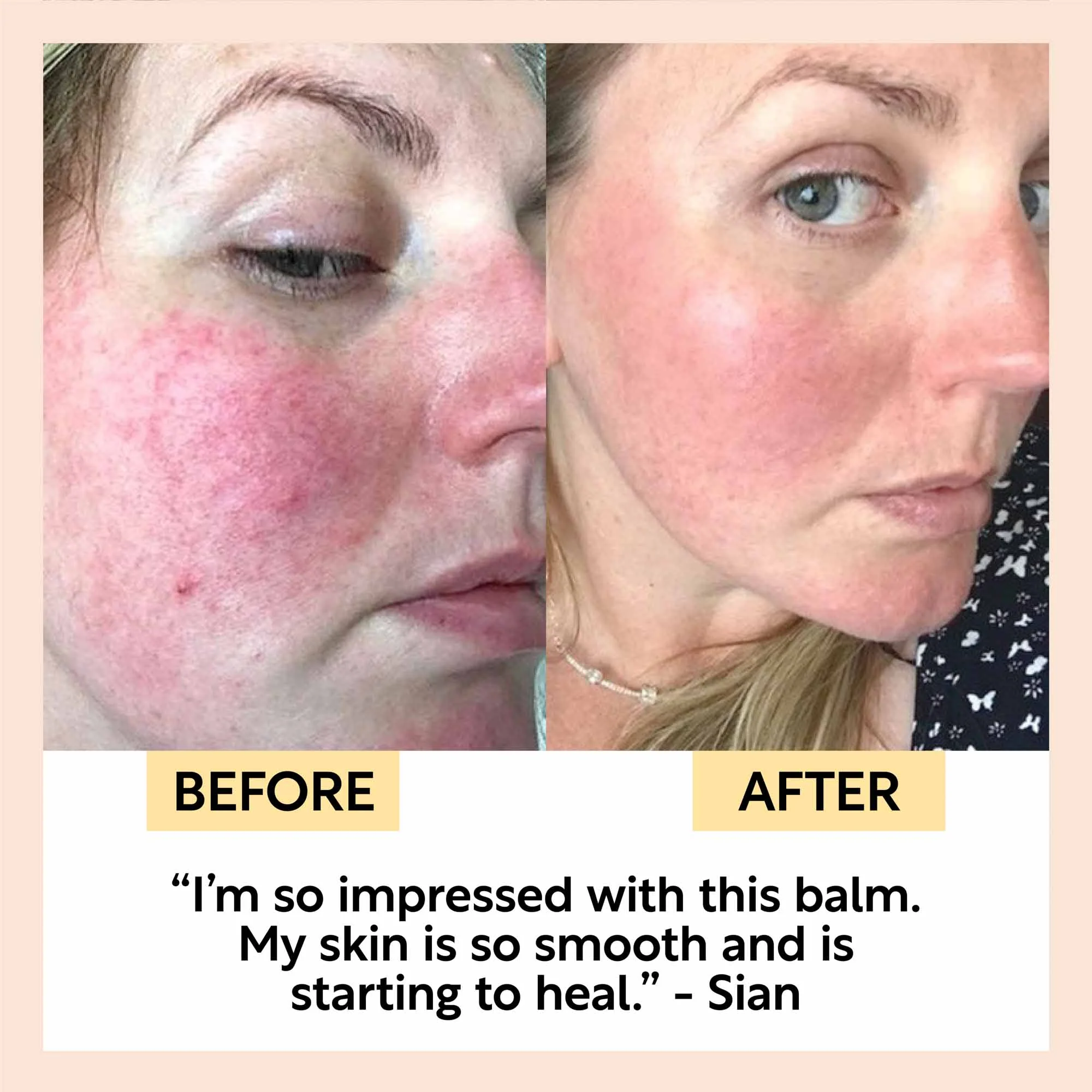 The Dry Skin Bundle - Image 7