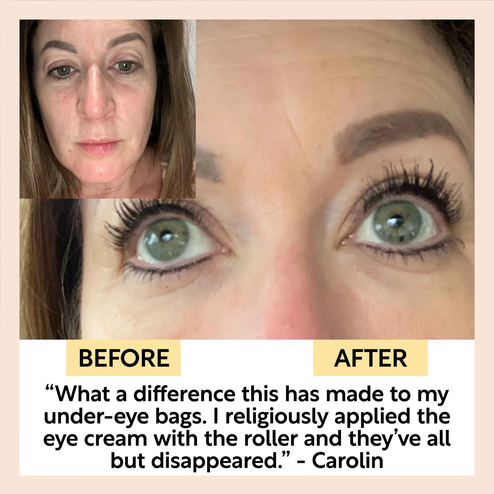 Eye Cream with Hyaluronic Acid + Coffee - Image 10
