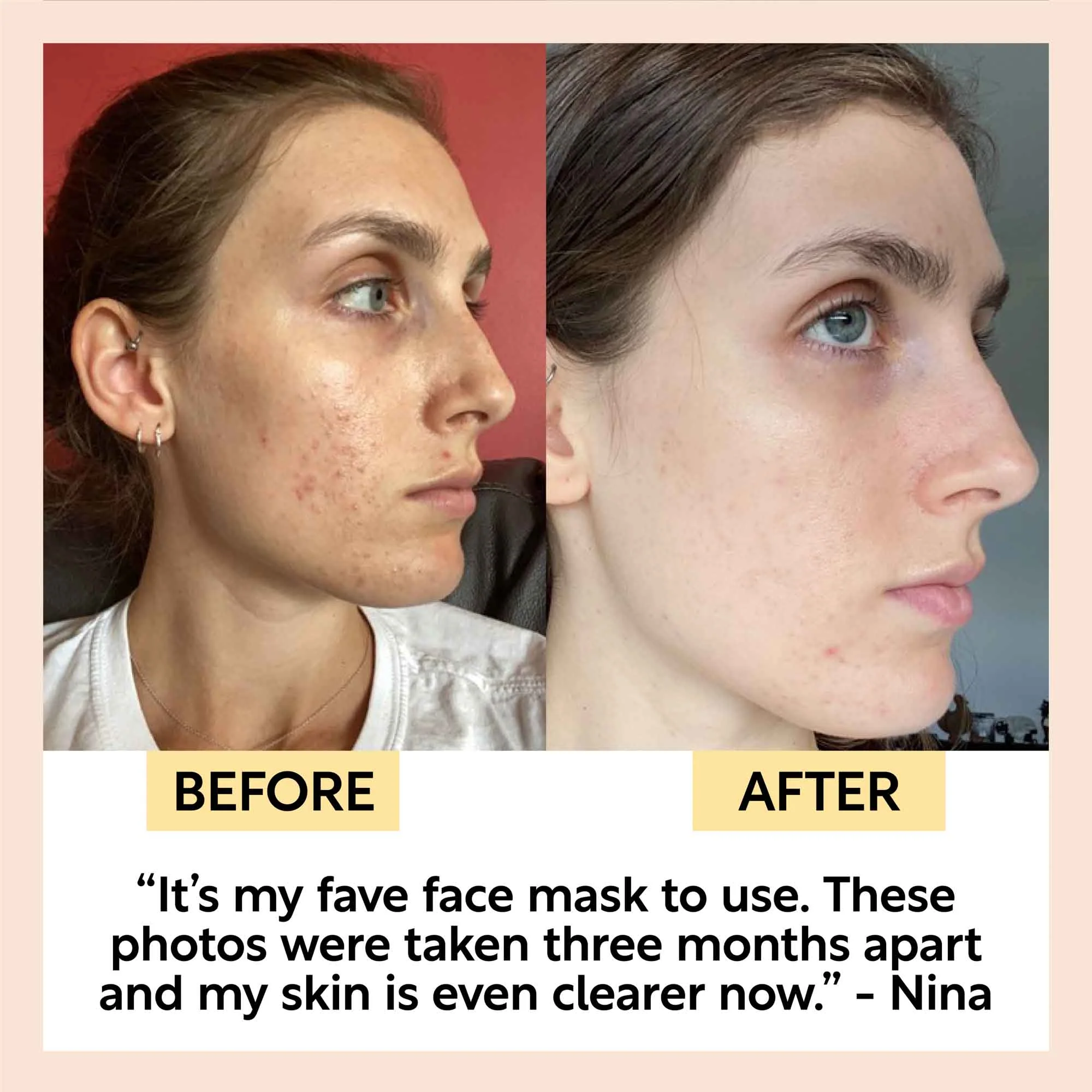 Kaolin Clay Face Mask - Image 6