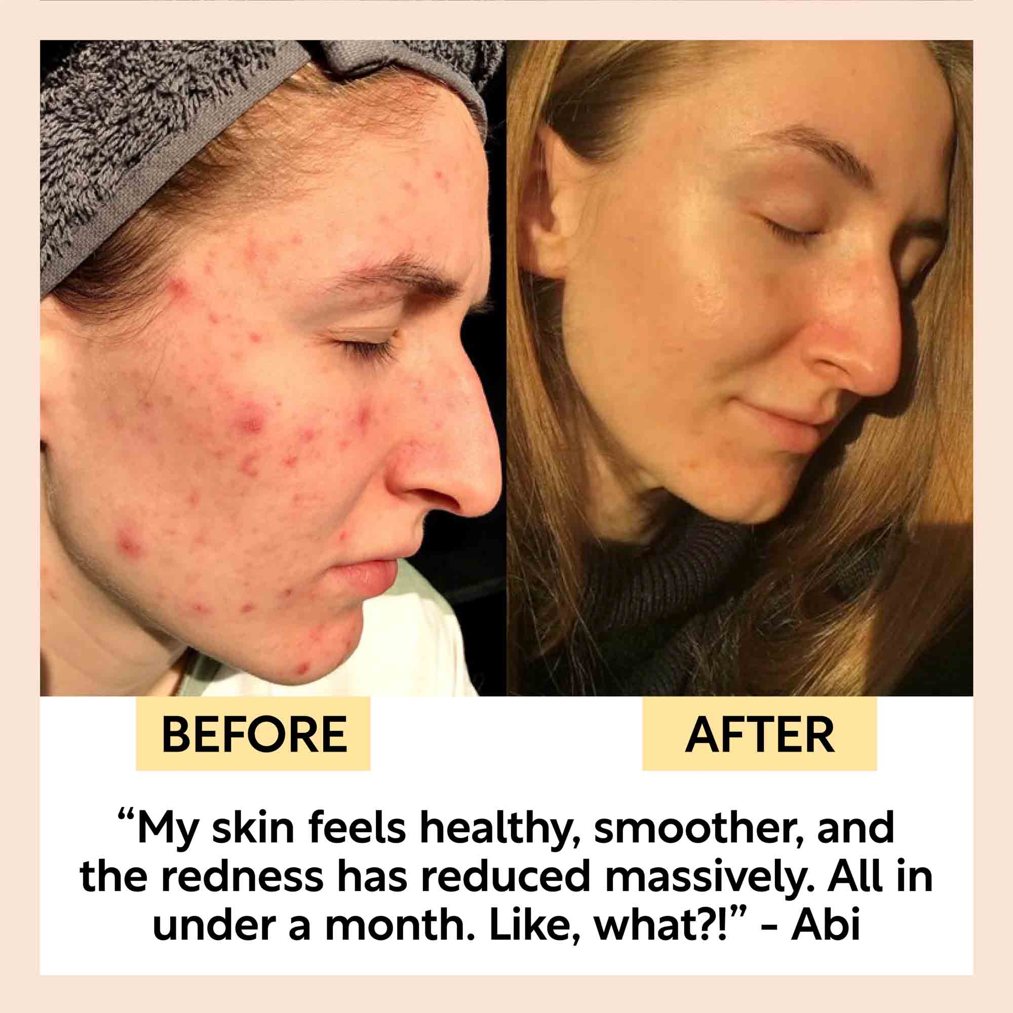 Kaolin Clay Face Mask - Image 7