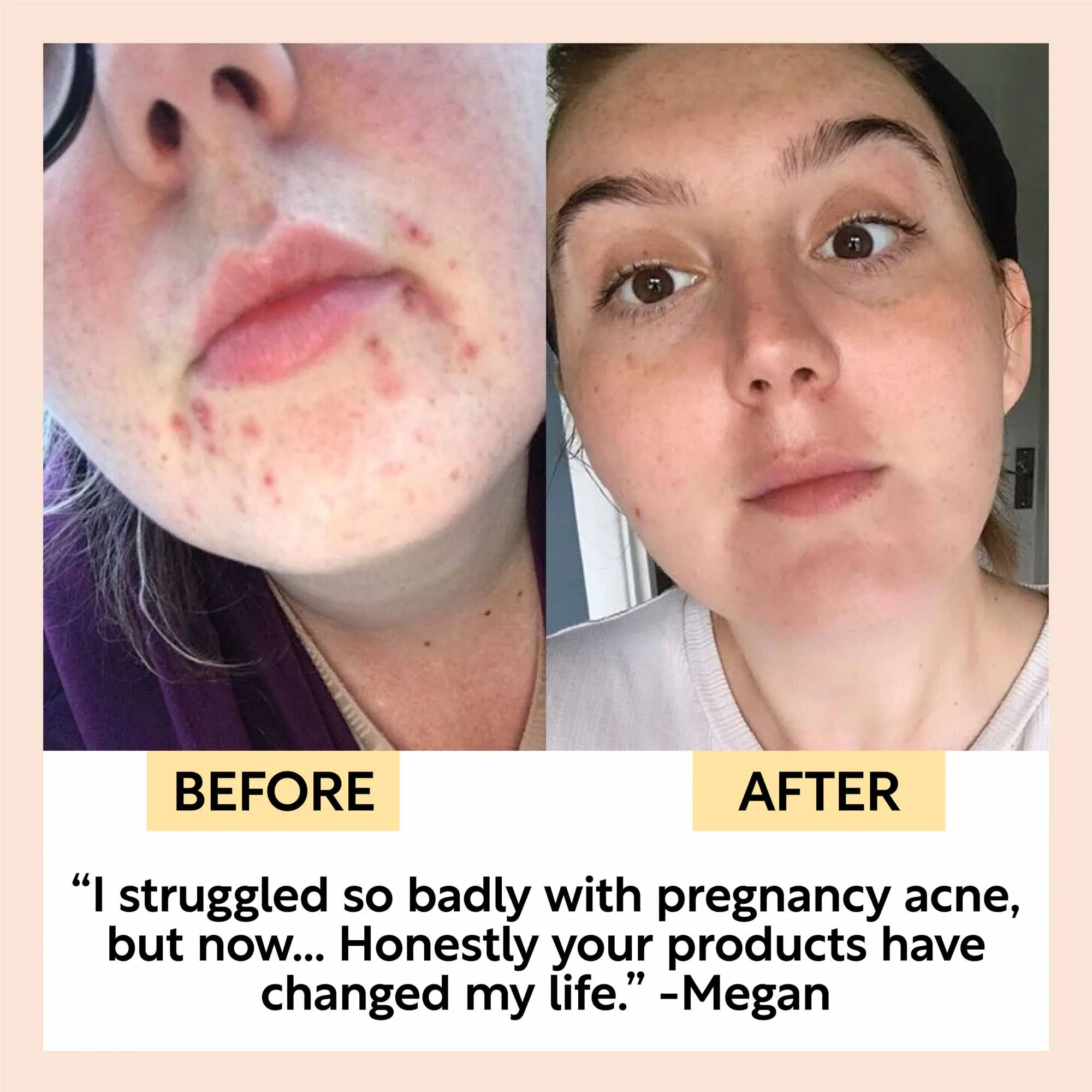 Face Moisturiser with Vitamin E - Jumbo - Image 8