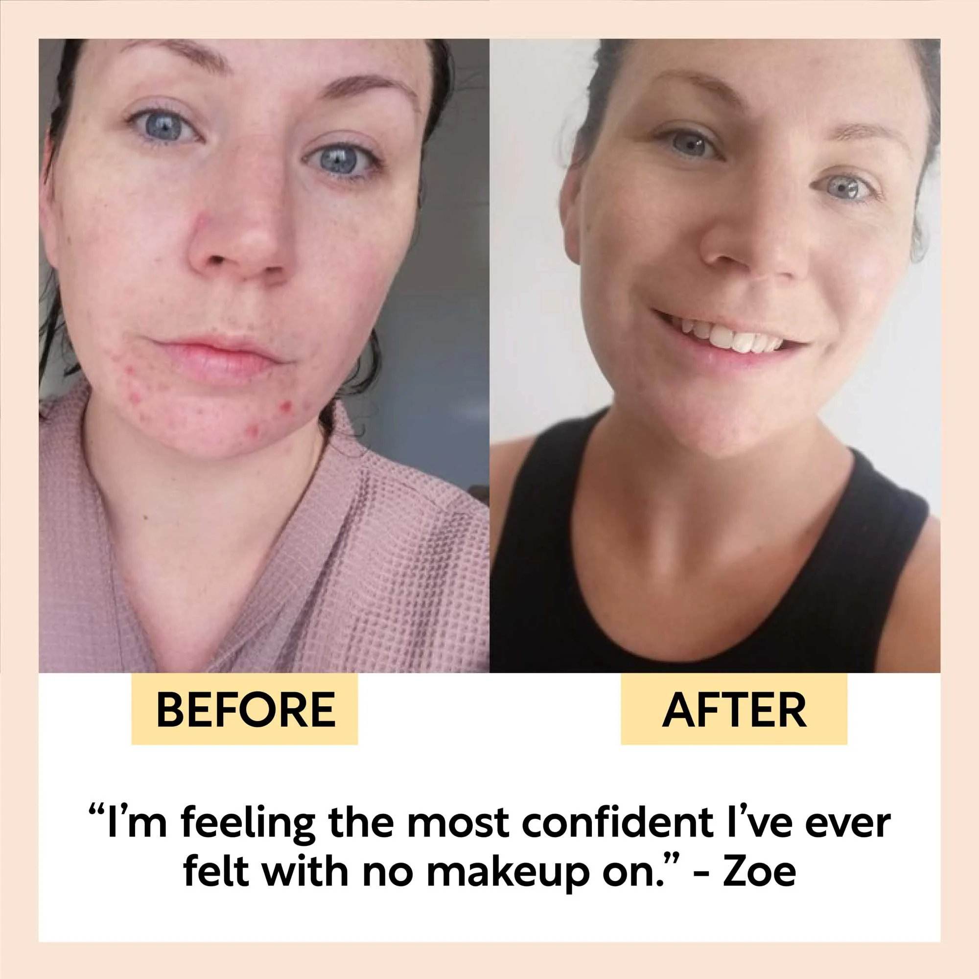 Ageing Gracefully Skincare Bundle - Image 8