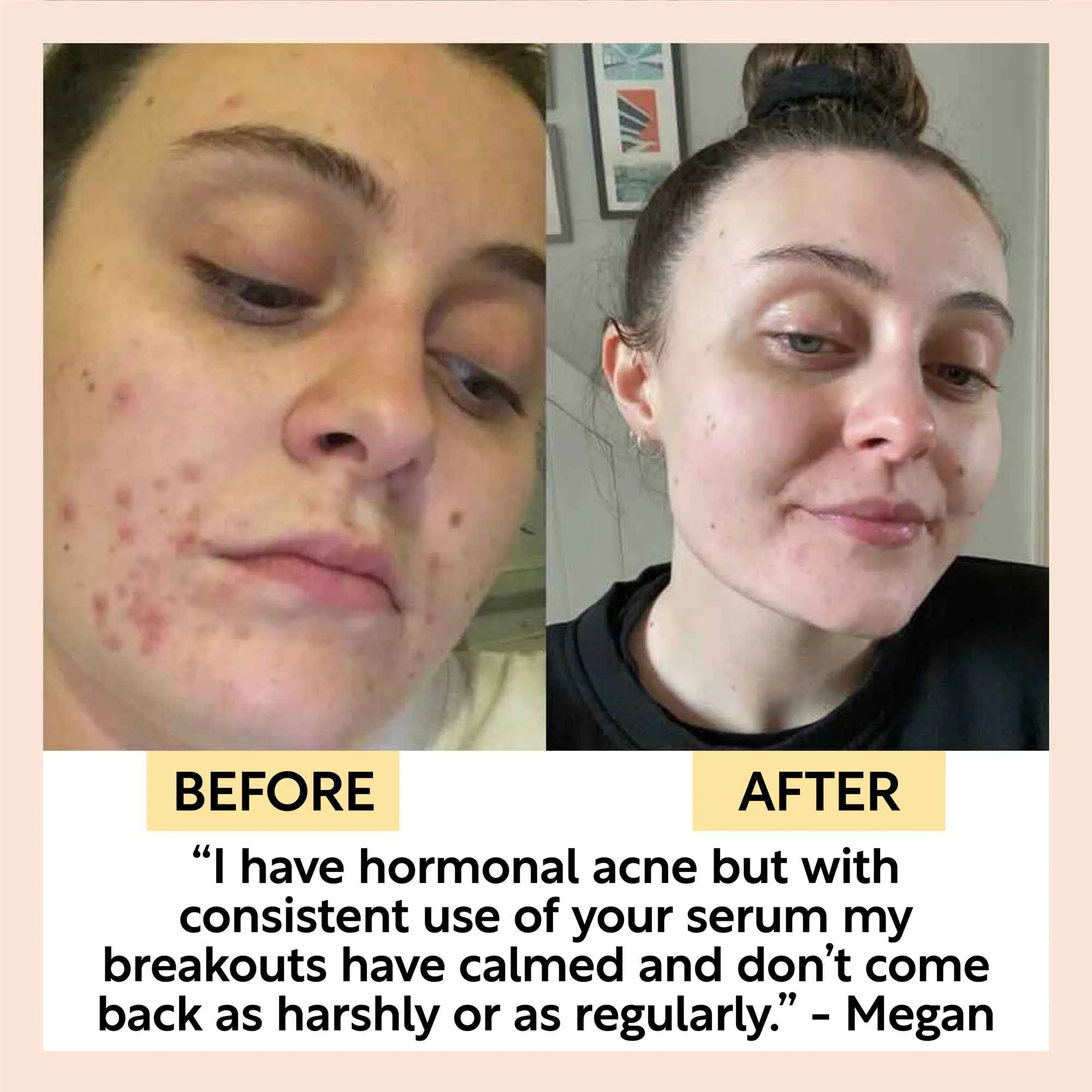 Hydration Skincare Set - Image 8