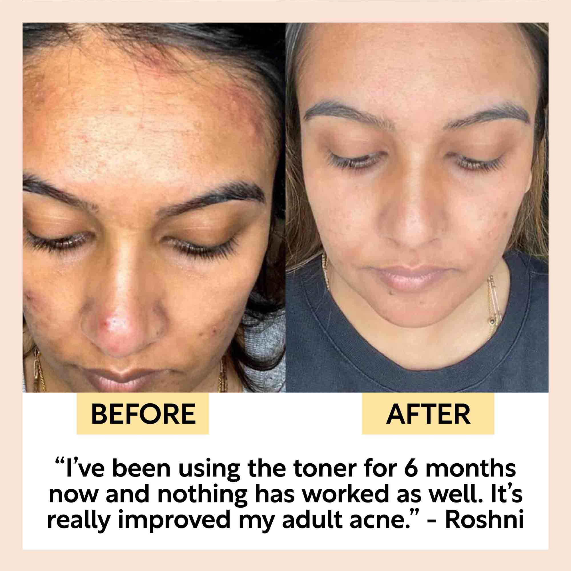 Face Toner with Hyaluronic Acid - Travel Size - Image 10