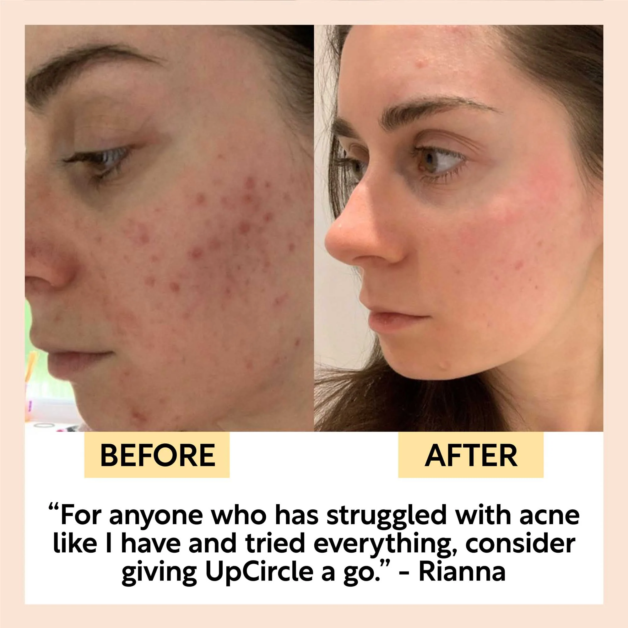 Face Toner with Hyaluronic Acid - Travel Size - Image 9