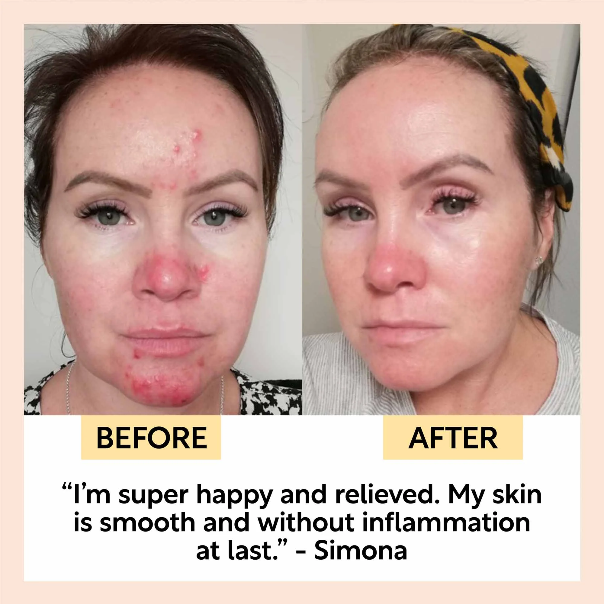 Night Cream with Hyaluronic Acid + Niacinamide - Travel Size - Image 8