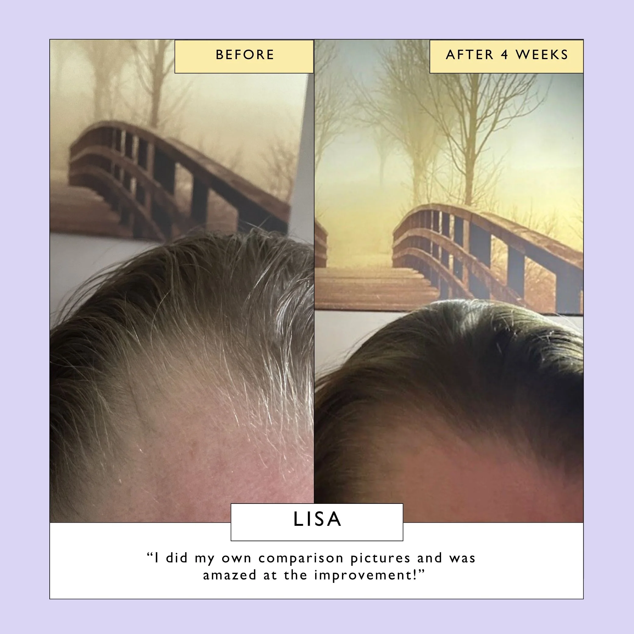 Scalp + Hair Oil with Bacuri Butter + Castor Oil - Image 4